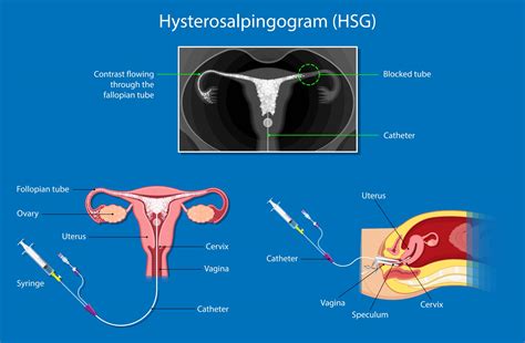 canvas hsg login